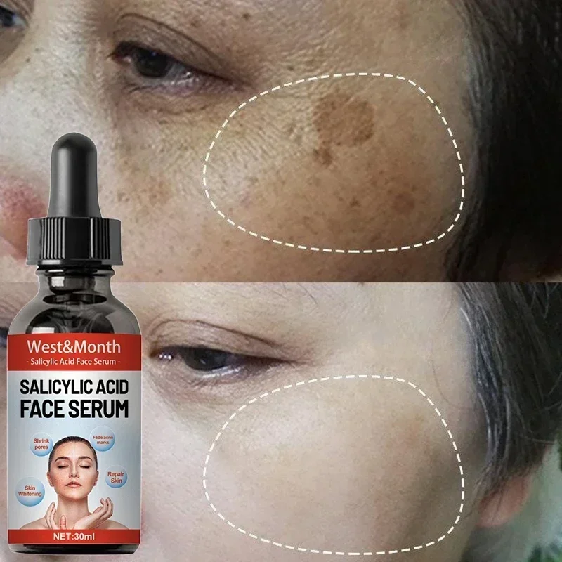 Licorice Root Extract - เซรั่มลดเลือนจุดด่างดำ ฝ้า กระ จุดด่างดำจากเมลานิน ปรับสีผิวให้กระจ่างใส สูตรเกาหลี