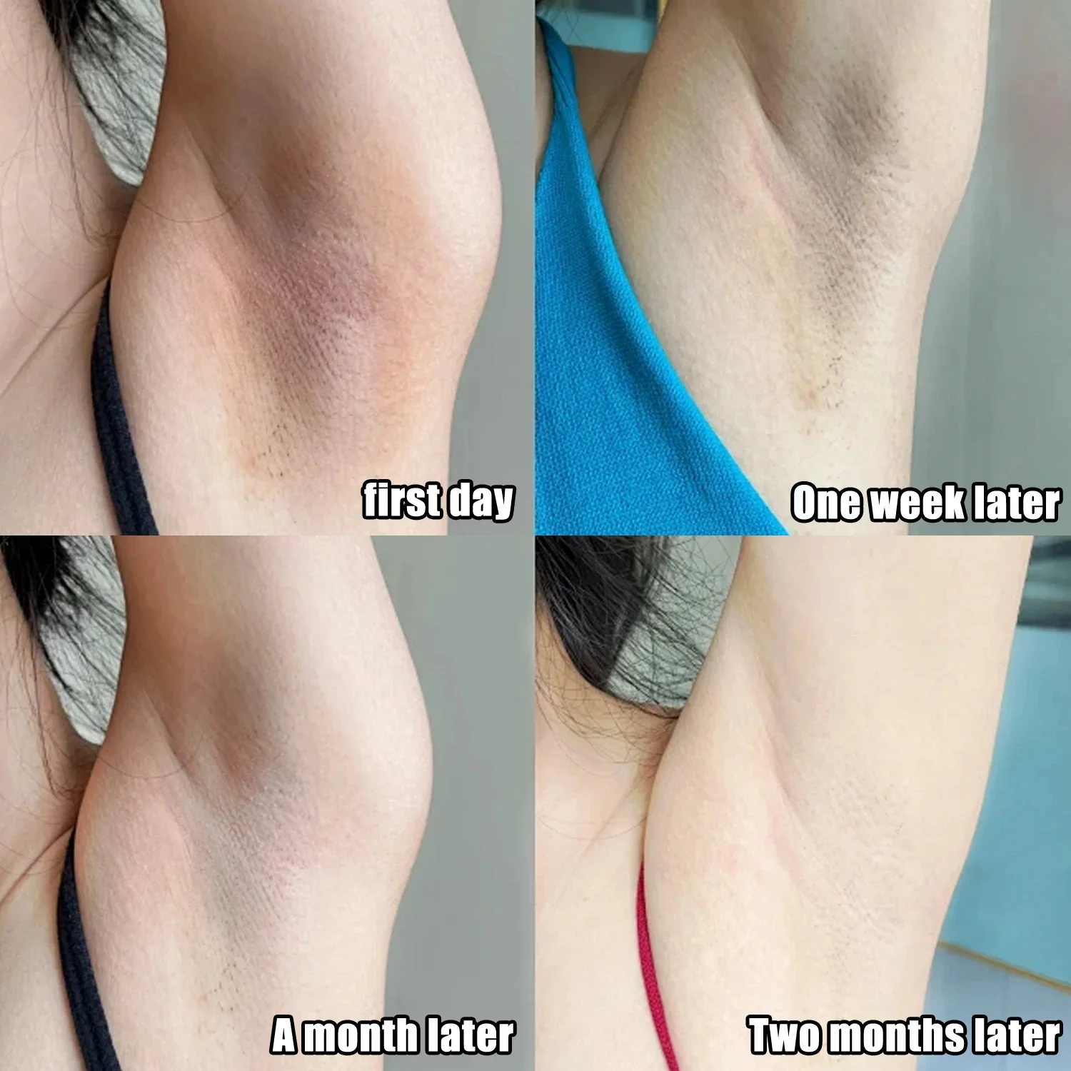 ครีมไวท์เทนนิ่งใต้วงแขนสำหรับผ - Skincare Collagen บทวิจารณ์และราคา