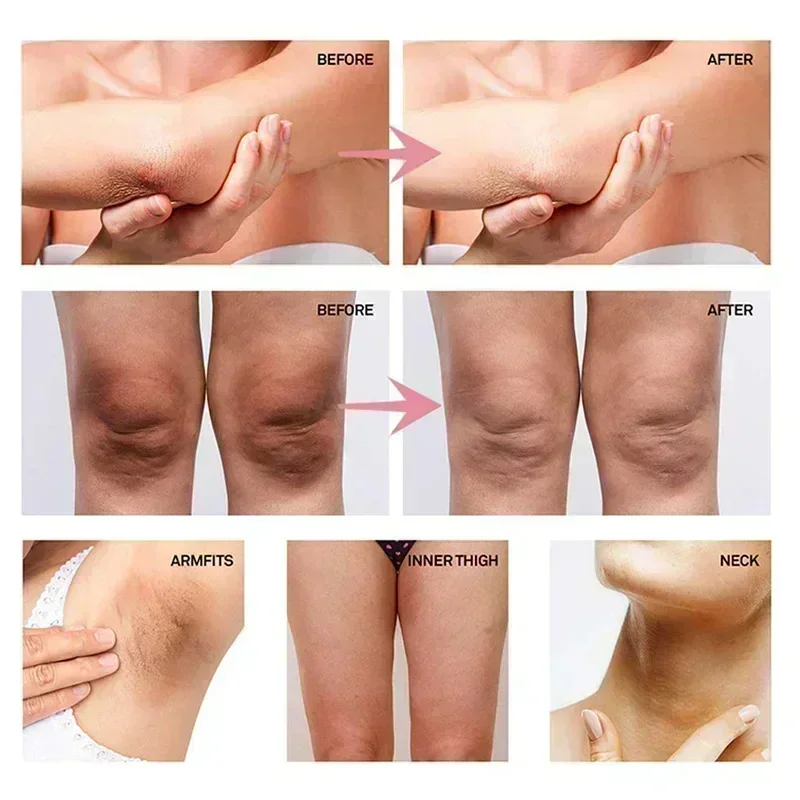 ครีมไวท์เทนนิ่งใต้วงแขนสำหรับผ - Skincare Collagen บทวิจารณ์และราคา