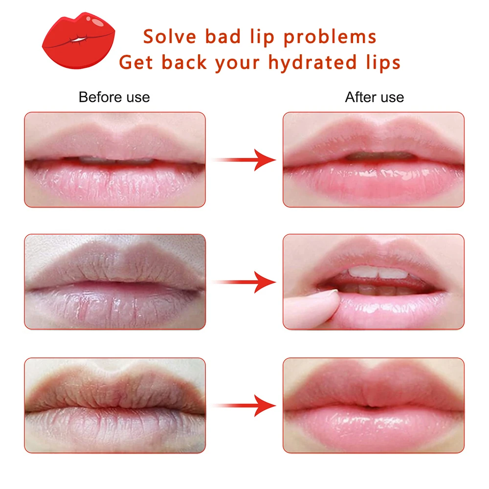 เชอร์รี่ คอลลาเจน แอนตี้เอจจิ้ - Skincare Collagen บทวิจารณ์และราคา
