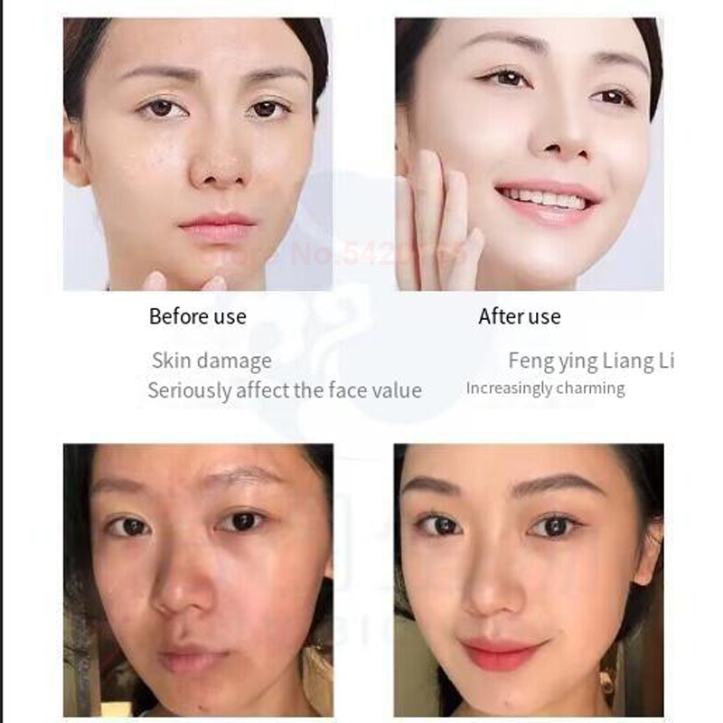 โพลีเปปไทด์แอคทีฟไฮยาลูโรนิกแอ - Licorice Root Extract บทวิจารณ์และราคา