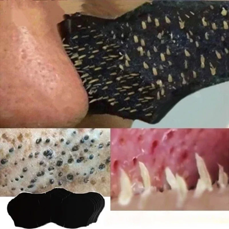 10 PC/50 PC100 PC Blackhead No - Skincare Viral Tiktok บทวิจารณ์และราคา