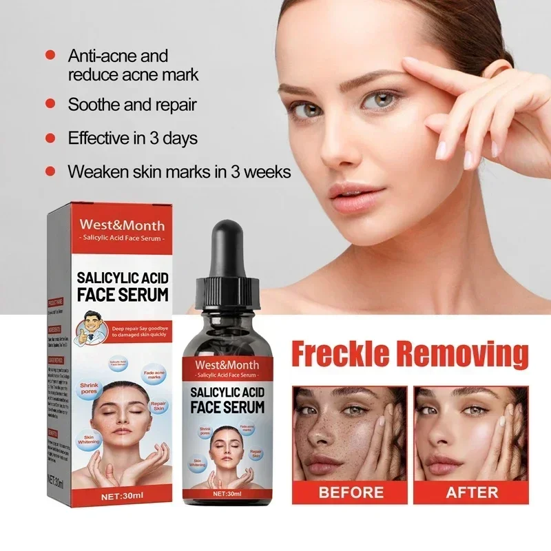 เซรั่มลดเลือนจุดด่างดำ ฝ้า กระ - Licorice Root Extract บทวิจารณ์และราคา